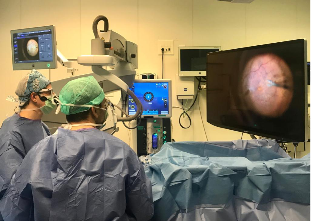 Chirurgie rétinienne 3D au bloc opératoire avec microscope ZEISS ARTEVO et écran haute définition